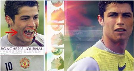 Cristiano ronaldo portait un appareil dentaire !!!!!